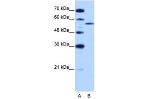 ZRSR2 antibody used at 2. (ZRSR2 抗体)