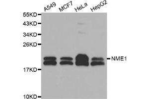 Western blot analysis of extracts of various cell lines, using NME1 antibody (ABIN5970089) at 1/1000 dilution. (NME1 抗体  (C-Term))