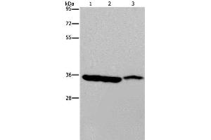 Western Blot analysis of Mouse heart, liver and stomach tissue using MDH1 Polyclonal Antibody at dilution of 1:500 (MDH1 抗体)
