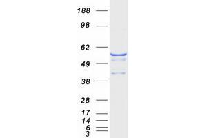 Western Blotting (WB) image for ATPase, H+ Transporting, Lysosomal 56/58kDa, V1 Subunit B1 (ATP6V1B1) protein (Myc-DYKDDDDK Tag) (ABIN2715055)