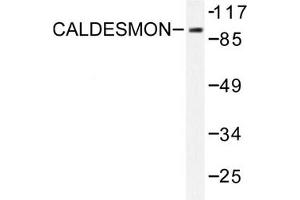 Image no. 1 for anti-Caldesmon 1 (CALD1) antibody (ABIN271923) (Caldesmon 抗体)