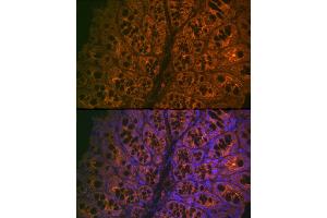 Immunofluorescence analysis of mouse large intestine cells using CE Rabbit mAb (ABIN7266085) at dilution of 1:100 (40x lens). (CEACAM6 抗体)