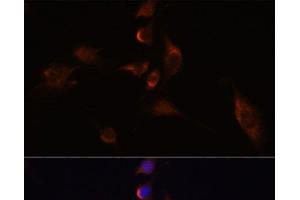 Immunofluorescence analysis of C6 cells using ELAVL3 Polyclonal Antibody at dilution of 1:100 (40x lens). (HuC/ELAVL3 抗体)