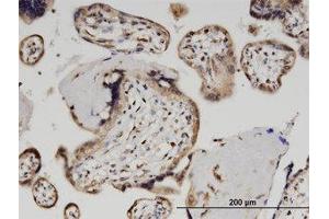 Image no. 1 for anti-Zinc Finger and SCAN Domain Containing 29 (ZSCAN29) (AA 101-200) antibody (ABIN599613) (ZSCAN29 抗体  (AA 101-200))