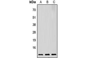 Western blot analysis of Prothymosin alpha expression in HeLa (A), Raw264. (PTMA 抗体  (C-Term))