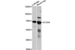 Western blot analysis of extracts of various cell lines, using SLC6A4 antibody. (SLC6A4 抗体)