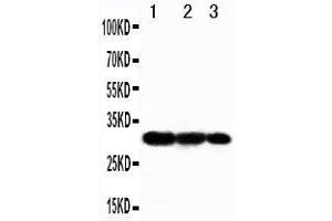 Western Blotting (WB) image for anti-TNF Receptor-Associated Factor 3 (TRAF3) (AA 387-403), (Middle Region) antibody (ABIN3042952) (TRAF3 抗体  (Middle Region))
