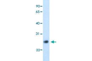 Western Blot analysis of human fetal kidney tissue lysate with GGTLC1 polyclonal antibody  at 5 ug/mL working concentration. (GGTLC1 抗体  (C-Term))