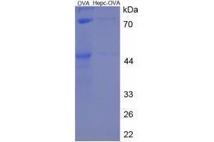 Image no. 2 for Hepcidin Antimicrobial Peptide (HAMP) peptide (Ovalbumin) (ABIN5666214) (Hepcidin Antimicrobial Peptide (HAMP) peptide (Ovalbumin))