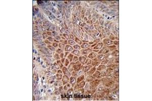 Formalin-fixed and paraffin-embedded human skin reacted with IGH Antibody (C-Term), which was peroxidase-conjugated to the secondary antibody, followed by DAB staining. (IgH 抗体  (C-Term))