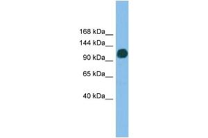 WB Suggested Anti-USP36 Antibody Titration: 0. (USP36 抗体  (N-Term))
