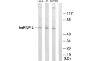 Western blot analysis of extracts from HeLa/Jurkat/HuvEc cells, using hnRNP L Antibody. (HNRNPL 抗体  (AA 61-110))