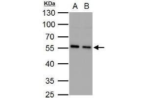 WB Image SQSTM1 antibody [N3C1], Internal detects SQSTM1 protein by western blot analysis. (SQSTM1 抗体)