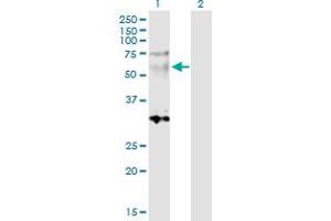 Western Blot analysis of SGCE expression in transfected 293T cell line by SGCE MaxPab polyclonal antibody. (SGCE 抗体  (AA 1-437))