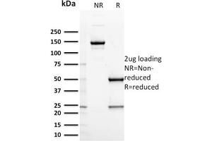 SDS-PAGE Analysis Purified CD127 Mouse Monoclonal Antibody (IL7R/2751). (IL7R 抗体  (AA 21-236))