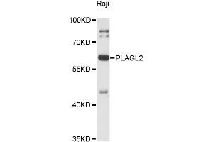 Western blot analysis of extracts of Raji cells, using PLAGL2 antibody (ABIN6292250) at 1:3000 dilution.