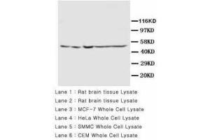 Image no. 2 for anti-Presenilin 2 (Alzheimer Disease 4) (PSEN2) (AA 319-334) antibody (ABIN1493957) (Presenilin 2 抗体  (AA 319-334))