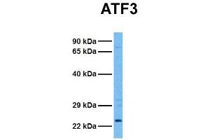 Host:  Rabbit  Target Name:  ATF3  Sample Tissue:  Human 293T  Antibody Dilution:  1. (ATF3 抗体  (Middle Region))