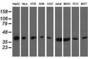 Western blot analysis of extracts (35 µg) from 9 different cell lines by using anti-HIBCH monoclonal antibody. (HIBCH 抗体)