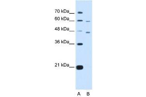 CRELD1 antibody used at 5 ug/ml to detect target protein.