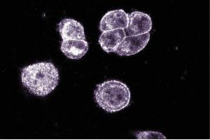 Pax-5 staining on paraformaldehyde-fixed SW-13 cells. (PAX5 抗体  (AA 151-306))