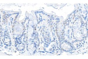 Immunohistochemistry (IHC) image for anti-Glyceraldehyde-3-Phosphate Dehydrogenase (GAPDH) (AA 150-200) antibody (ABIN7454519) (GAPDH 抗体  (AA 150-200))