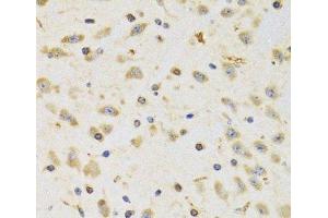 Immunohistochemistry of paraffin-embedded Rat brain using RPS12 Polyclonal Antibody at dilution of 1:100 (40x lens). (RPS12 抗体)