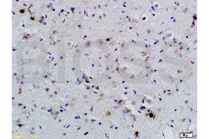 Formalin-fixed and paraffin-embedded rat brain labeled with Anti-BNP Polyclonal Antibody, Unconjugated (ABIN678623) 1:200, overnight at 4 °C, The secondary antibody was Goat Anti-Rabbit IgG, Cy3 conjugated used at 1:200 dilution for 40 minutes at 37 °C. (BNP 抗体  (AA 85-115))