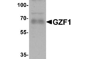 Western blot analysis of GZF1 in human heart tissue lysate with GZF1 antibody at 1 µg/mL. (ZNF336 抗体  (C-Term))