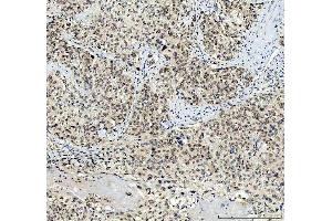 IHC analysis of TBX18 using anti-TBX18 antibody (ABIN7599494).