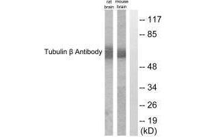 Western blot analysis of extracts from rat cells and mouse brain cells, using Tubulin β antibody. (TUBB3 抗体  (C-Term))