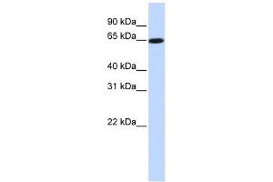 SLC43A1 antibody used at 1 ug/ml to detect target protein. (SLC43A1 抗体  (Middle Region))