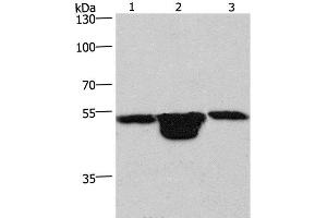 Western Blot analysis of Hela cell, Mouse muscle and kidney tissue using PLEKHO1 Polyclonal Antibody at dilution of 1:200 (PLEKHO1 抗体)