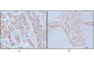 Immunohistochemical analysis of paraffin-embedded human breast cancer,Lung breast tissues using EGF mouse mAb (EGF 抗体)