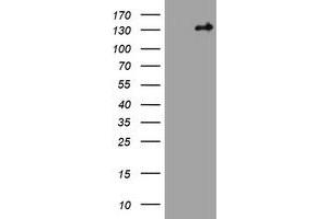 Image no. 1 for anti-Tuberous Sclerosis 1 (TSC1) (AA 836-1164) antibody (ABIN1491686) (TSC1 抗体  (AA 836-1164))