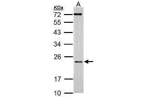WB Image Sample (30 ug of whole cell lysate) A: 293T 12% SDS PAGE antibody diluted at 1:500 (AICDA 抗体  (N-Term))