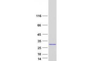 Western Blotting (WB) image for Crystallin, beta A2 (CRYbA2) (Transcript Variant 3) protein (Myc-DYKDDDDK Tag) (ABIN2715235)