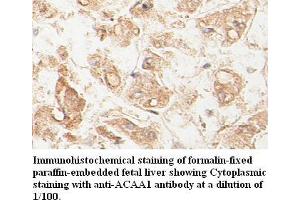 Image no. 1 for anti-Acetyl-CoA Acyltransferase 1 (ACAA1) antibody (ABIN791175) (ACAA1 抗体)