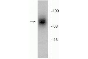 Western blot of human striatal lysate showing specific immunolabeling of the ~88 kDa DAT protein. (SLC6A3 抗体  (Extracellular Loop))
