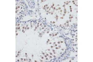 Immunohistochemistry (Paraffin-embedded Sections) (IHC (p)) image for anti-Nucleolar Protein 3 (Apoptosis Repressor with CARD Domain) (NOL3) (AA 1-208) antibody (ABIN6144704)