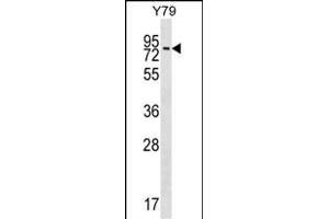 K Antibody  (ABIN391782 and ABIN2841639) western blot analysis in Y79 cell line lysates (35 μg/lane). (MAK 抗体  (C-Term))