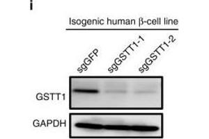 Western Blotting (WB) image for anti-Glutathione S-Transferase theta 1 (GSTT1) antibody (ABIN2856663)