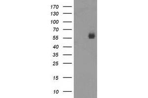 Western Blotting (WB) image for anti-Poliovirus Receptor-Related 1 (Herpesvirus Entry Mediator C) (PVRL1) antibody (ABIN1499678) (PVRL1 抗体)