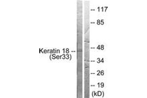 Western blot analysis of extracts from HT29 cells, using Keratin 18 (Phospho-Ser33) Antibody. (Cytokeratin 18 抗体  (pSer34))