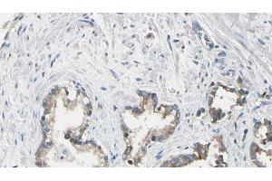 ABIN6275433 at 1/100 staining Human prostate tissue by IHC-P. (CHML 抗体  (Internal Region))