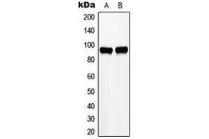 Western blot analysis of ZHX2 expression in HepG2 (A), K562 (B) whole cell lysates. (ZHX2 抗体  (C-Term))