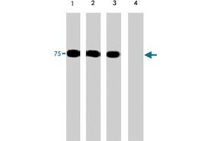 Western blots of human PAK6 recombinant protein phosphorylated by ERK2. (PAK6 抗体  (N-Term))