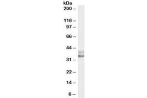 Western blot testing of HeLa (nuclear) cell lysate with NANOG antibody at 0. (Nanog 抗体)