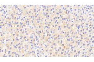 Immunohistochemistry (IHC) image for anti-Tight Junction Protein 2 (Zona Occludens 2) (TJP2) (AA 307-669) antibody (ABIN7441247)