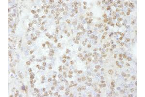 Immunohistochemistry (IHC) image for anti-RNA Binding Motif Protein 16 (RBM16) (C-Term) antibody (ABIN7448761) (RBM16 抗体  (C-Term))